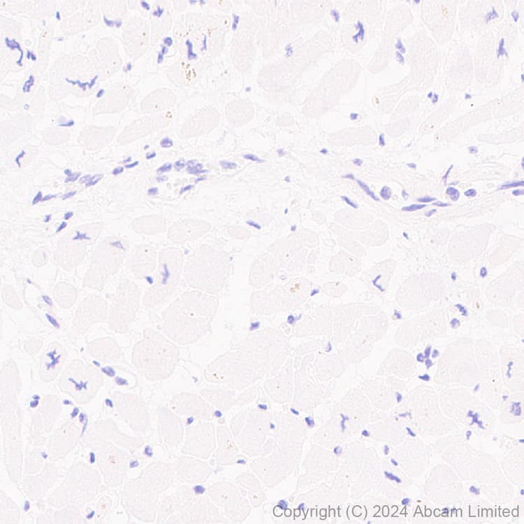 Atp6v0d2 Antibody Epr29173 521 Bsa And Azide Free Ab321810  Immunohistochemistry Formalin Pfa Fixed Paraffin Embedded Sections Img435569