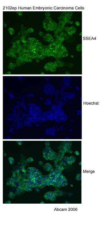 Anti-SSEA4 antibody [MC813-70](AB16287)