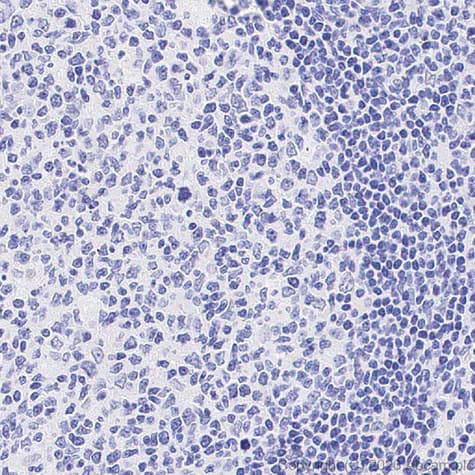 Immunohistochemistry (Formalin/PFA-fixed paraffin-embedded sections) - Anti-PRAME antibody [EPR20330] (ab219650)