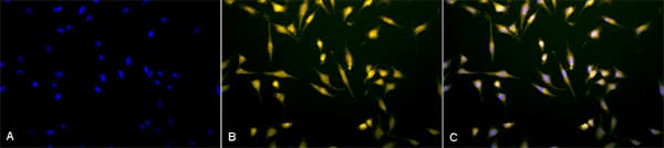 Rab5 Antibody Early Endosome Marker Ab13253  Immunocytochemistry Immunofluorescence Img167007