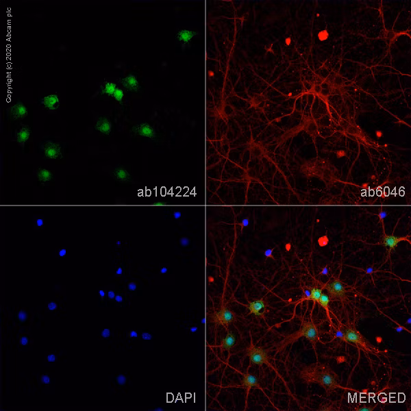 Fluorescent staining of primary hippocampal rat neurons/glia showing NeuN (green), beta Tubulin (red), and DAPI-labeled nuclei (blue).