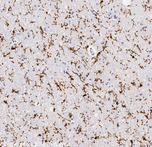 IHC staining of Iba1 in human normal hippocampus.