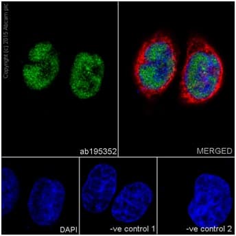 Anti-METTL3 antibody [EPR18810](AB195352)