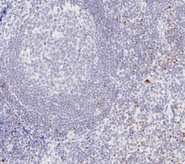 Foxp3 Antibody Epr15038 69 Ab191416  Immunohistochemistry Formalin Pfa Fixed Paraffin Embedded Sections Img115345