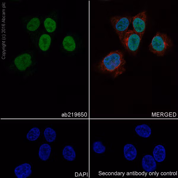 Confocal immunofluorescent image of A-375 melanoma cells showing nuclear PRAME protein staining. Cells fixed with 4% paraformaldehyde, permeabilized with 0.1% Triton X-100, and labeled with PRAME antibody (ab219650, 1/500) and Alexa Fluor® 488 (ab150077, 1/1000)