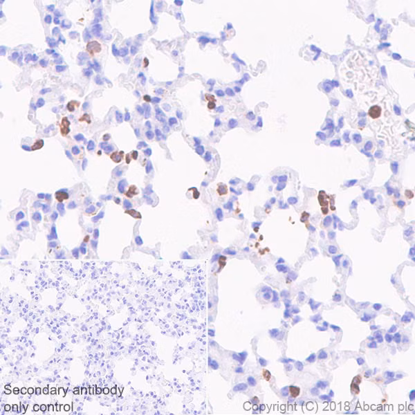 Immunohistochemical staining of CD11b in mouse lung tissue sections.