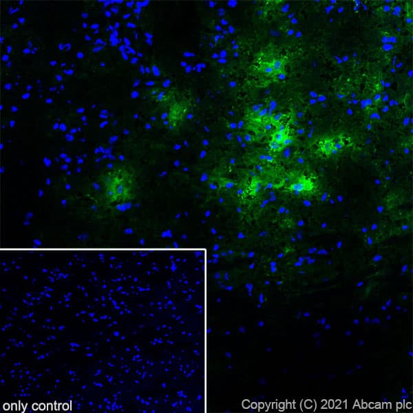 Anti-TPH2 antibody [EPR25100-29] - BSA and Azide free(AB288068)