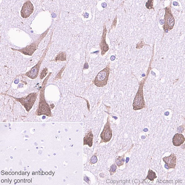 Rpl9 Antibody Ep13752 Bsa And Azide Free Ab284834  Immunohistochemistry Formalin Pfa Fixed Paraffin Embedded Sections Img407586