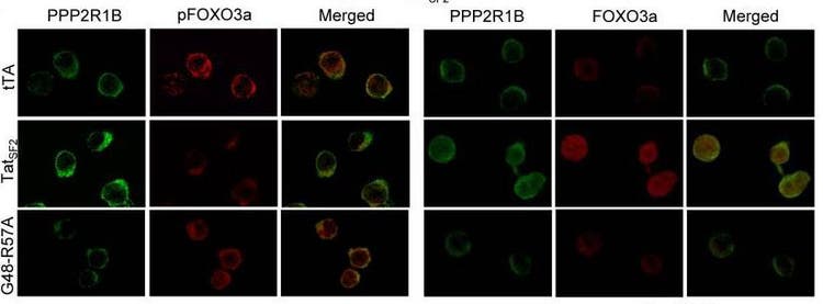 Microscopic image of HIV-infected and control Jurkat T cells stained with antibodies to show protein levels. Green: PPP2R1B, Red: pFOXO3a and FOXO3a.