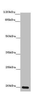 Zmat5 Antibody Ab235355  Western Blot Img161732