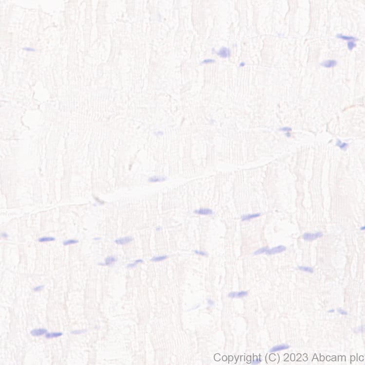 Pan Cytokeratin Antibody Epr28285 45 Bsa And Azide Free Ab308263  Immunohistochemistry Formalin Pfa Fixed Paraffin Embedded Sections Img408898