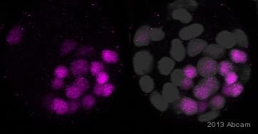 Anti-SOX2 antibody [EPR3131](AB92494)