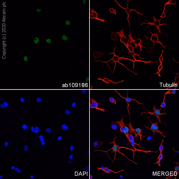 Immunofluorescent staining of Olig2, Tubulin, and DAPI in rat primary glia cells.