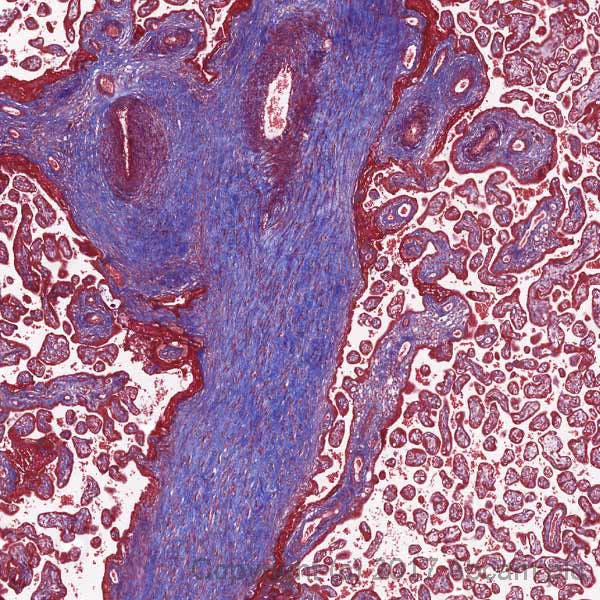 Trichrome stain of normal human placenta showing collagen (blue), muscle fibers (red), and nuclei (blue).
