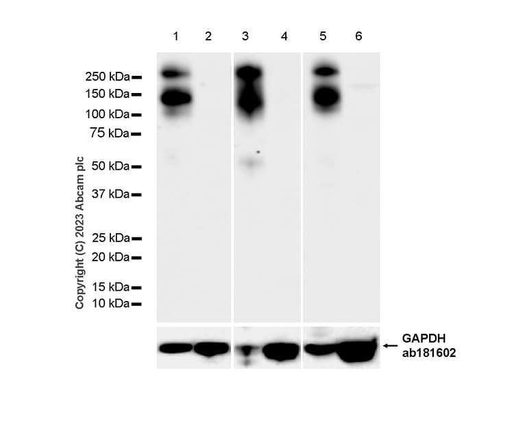 Casr Antibody Epr24050 59 Bsa And Azide Free Ab280360  Western Blot Img417314