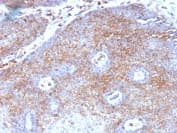 Beta 2 Microglobulin Antibody B2m 1118 Bsa And Azide Free Ab212752  Immunohistochemistry Formalin Pfa Fixed Paraffin Embedded Sections Img133697