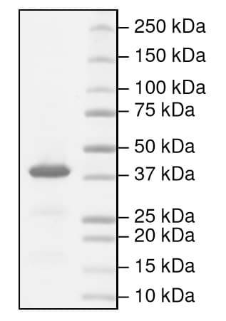 Ab216193  Sds Page Img56763