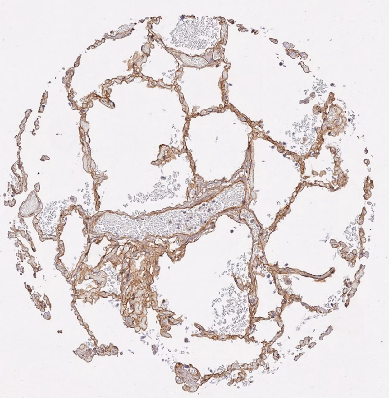 Immunohistochemical analysis formalin-fixed paraffin-embedded human lung tissue labelling Collagen IV with ab6586 at 1/15 dilution for 1 hour at 37 °C followed by a ready to use Polymer-HRP, Rabbit/Mouse Detection Kit.