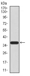 Anti-KDM2B antibody [6F6G11](AB234082)