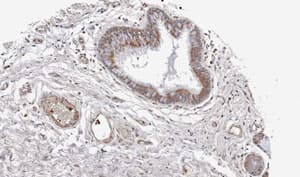 Wnt11 Antibody Ab96730  Immunohistochemistry Formalin Pfa Fixed Paraffin Embedded Sections Img34423