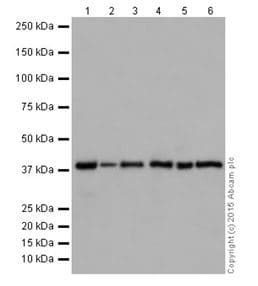 Anti-ATP6V0D1/P39 antibody [EPR18320-38](AB202899)