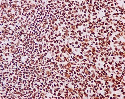 Anti-HMGB1 antibody [EPR3507](AB79823)