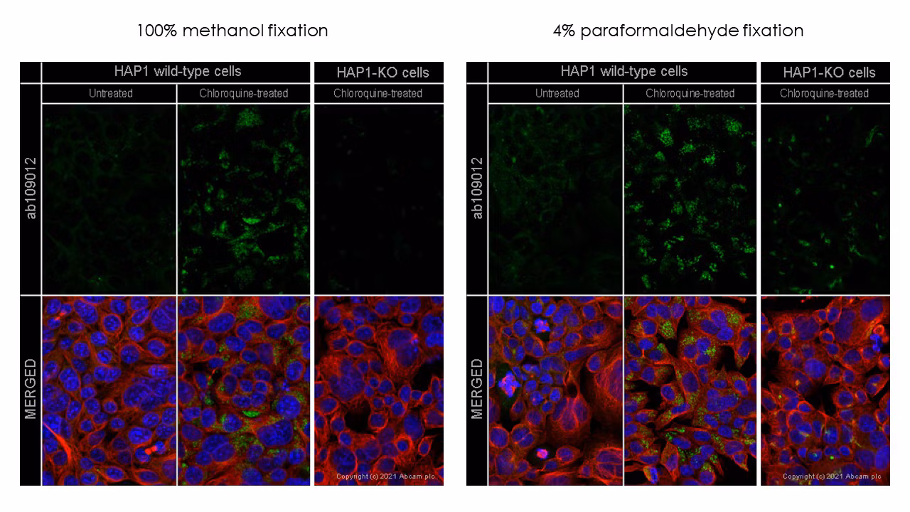 Confocal microscope image showing SQSTM1 localization in wild-type and knockout Hap1 cells treated with chloroquine.