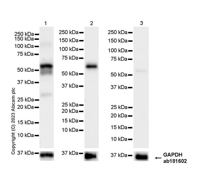 Pan Cytokeratin Antibody Epr28285 45 Bsa And Azide Free Ab308263  Western Blot Img408853