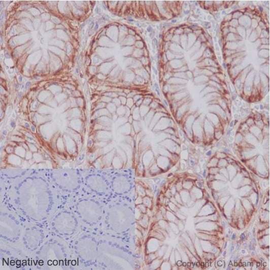 Plasma Membrane Marker (Na/K ATPase, pan Cadherin, PMCA1) Antibody Sampler Panel - Human, Mouse(AB254025)