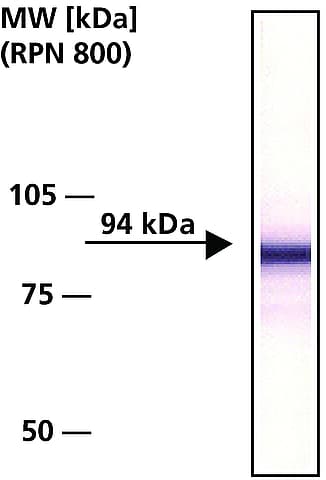 Anti-beta Catenin antibody(AB6302)