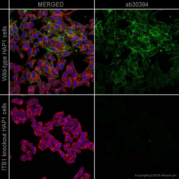 Anti-Integrin beta 1 antibody [12G10](AB30394)