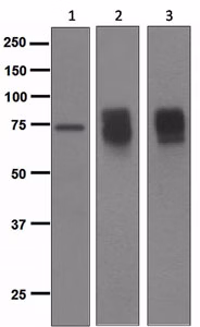Western blot: Anti-Somatostatin receptor 2 antibody (ab134152, 1/1000). Lane 1: U937 lysates. Lane 2: INS-1 lysates. Lane 3: HEK-293 lysates (transfected)
