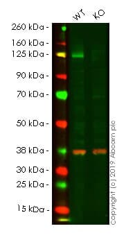N Cadherin Antibody Epr1791 4 Bsa And Azide Free Ab271856  Western Blot Img178416