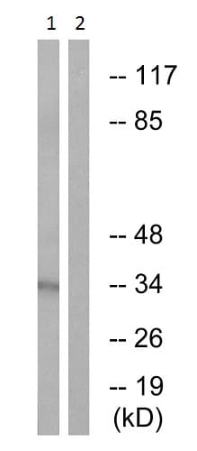 Anti-RPA32/RPA2 (phospho T21) antibody(AB61065)
