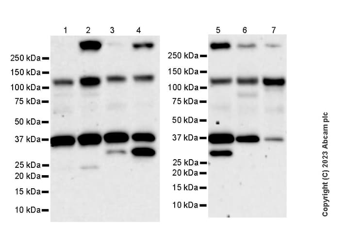 Anti-CBLB antibody [EPR28082-32](AB315021)