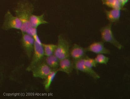 Anti-CEACAM5 + CEACAM6 antibody [NCRC16 (AKA 161)](AB22705)