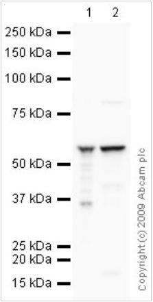 Western blot - Total OXPHOS Rodent WB Antibody Cocktail (ab110413)