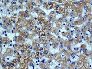 Cytochrome P450 4a Cyp4a11 Antibody Epr8276 Bsa And Azide Free Ab248918  Immunohistochemistry Formalin Pfa Fixed Paraffin Embedded Sections Img71483