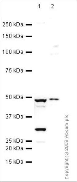 Western blot - Total OXPHOS Rodent WB Antibody Cocktail (ab110413)