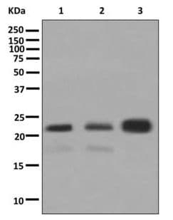 Arl15 Antibody Epr12591 Ab178425  Western Blot Img148030