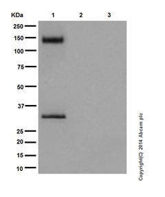 Western blot analysis of TrkB expression in human fetal brain, heart, and spleen tissues.