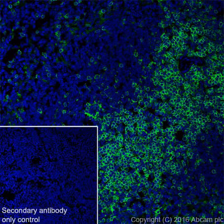 Immunohistochemical staining of mouse spleen tissue showing CD4 expression, labeled with ab183685 and Alexa Fluor® 488-conjugated secondary antibody (green)