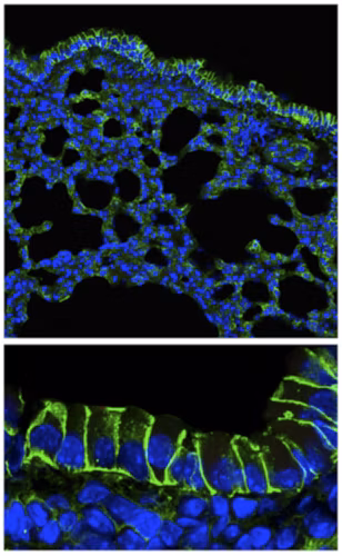 Sodium Potassium ATPase staining in mouse lung epithelia (IHC).