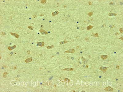 Bestrophin Best1 Antibody Ab14929  Immunohistochemistry Formalin Pfa Fixed Paraffin Embedded Sections Img108433