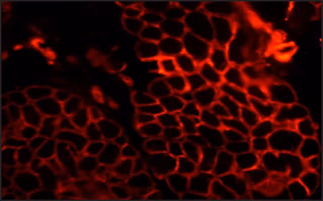 Immunohistochemical staining of human tonsil tissue for Laminin using ab11575 at 1:50 dilution