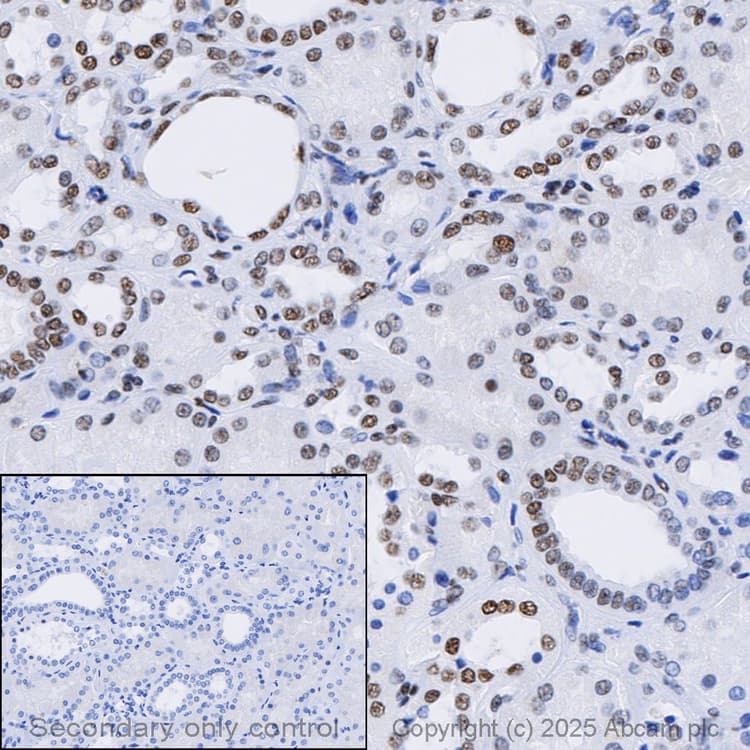 Anti-ARID1A antibody [EPR13501](AB182560)