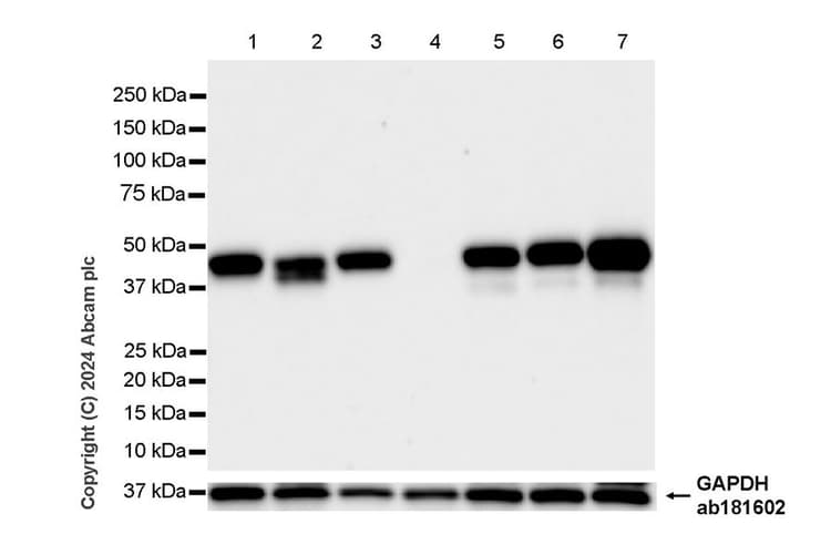 Anti-HLA Class 1 abC antibody [EMR8-5](ab70328)