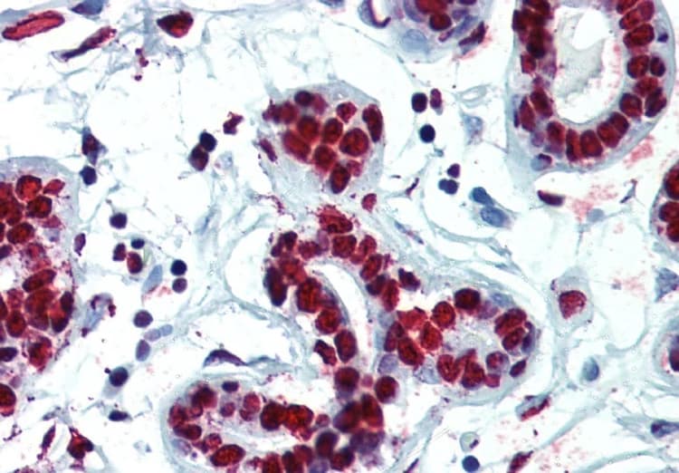 Hnrnp C1 C2 Antibody 4f4 Ab316365  Immunohistochemistry Formalin Pfa Fixed Paraffin Embedded Sections Img426790