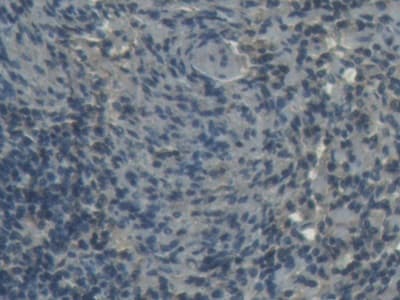 Anti-H-FabP antibody(ab231568)