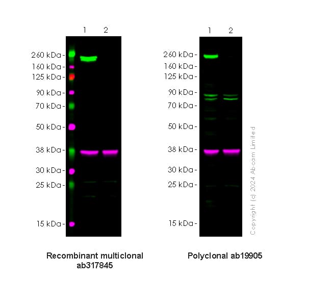 Dnmt1 Antibody Rm1192 Ab317845  Western Blot Img434399